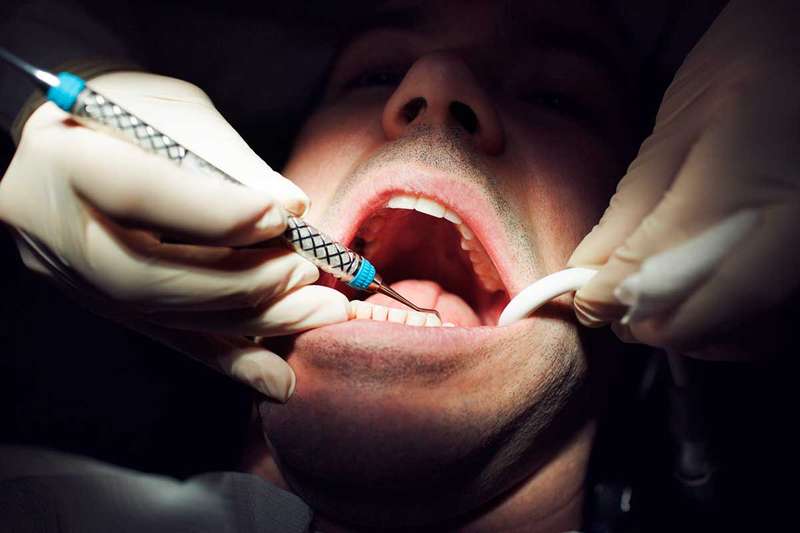 Dentists can smell your fear – and it may put your teeth at risk | New Scientist