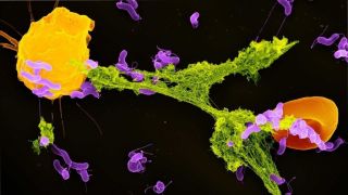 How ‘Spider-Man’ and ‘Pac-Man’ immune cells team up to fight invasive bacteria | Livescience